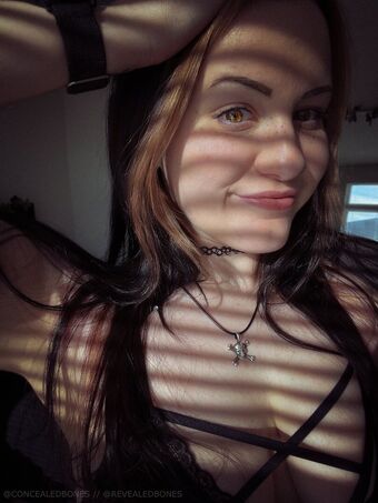 ConcealedBones