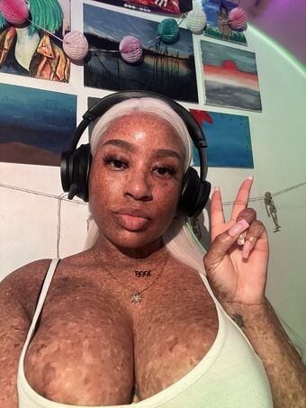 freckledn