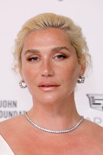 Kesha