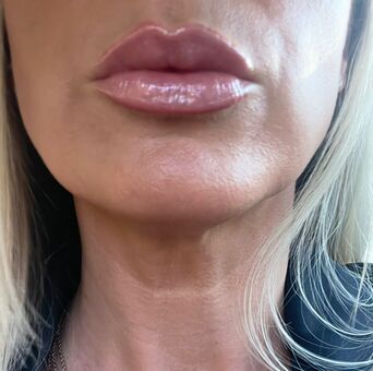 Nipsstrips Foto Nude Leaked OnlyFans 4