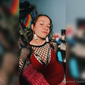 spottedhottie21